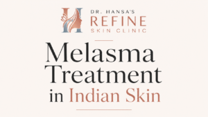 melasma treatment in indian skin